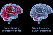 Guarire dal trauma con la tecnica dell'EMDR
