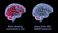 Guarire dal trauma con la tecnica dell'EMDR